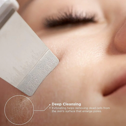 LUXEFLASH® Blackhead Remover